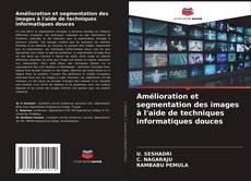 Couverture de Amélioration et segmentation des images à l'aide de techniques informatiques douces