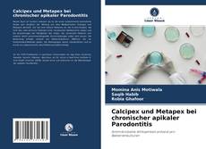 Bookcover of Calcipex und Metapex bei chronischer apikaler Parodontitis