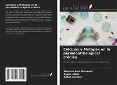 Buchcover von Calcipex y Metapex en la periodontitis apical crónica