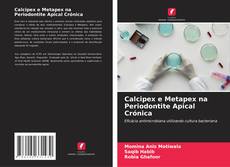 Bookcover of Calcipex e Metapex na Periodontite Apical Crónica