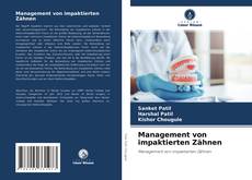 Обложка Management von impaktierten Zähnen