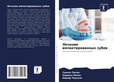 Buchcover von Лечение импактированных зубов