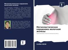 Метапластическая карцинома молочной железы的封面