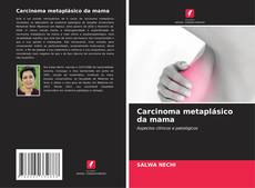 Copertina di Carcinoma metaplásico da mama