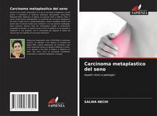 Обложка Carcinoma metaplastico del seno
