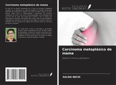 Copertina di Carcinoma metaplásico de mama