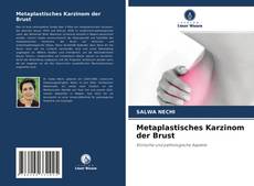 Copertina di Metaplastisches Karzinom der Brust