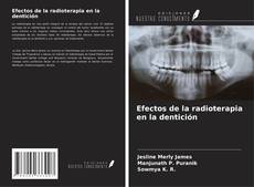 Buchcover von Efectos de la radioterapia en la dentición