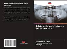Couverture de Effets de la radiothérapie sur la dentition