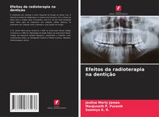 Efeitos da radioterapia na dentição的封面