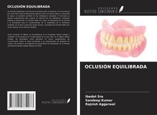 OCLUSIÓN EQUILIBRADA的封面