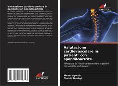 Capa do livro de Valutazione cardiovascolare in pazienti con spondiloartrite 