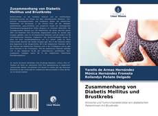 Copertina di Zusammenhang von Diabetis Mellitus und Brustkrebs