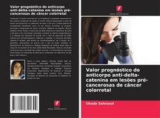Borítókép a  Valor prognóstico do anticorpo anti-delta-catenina em lesões pré-cancerosas de câncer colorretal - hoz