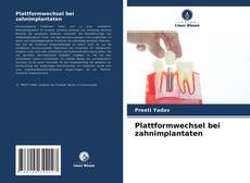 Buchcover von Plattformwechsel bei zahnimplantaten