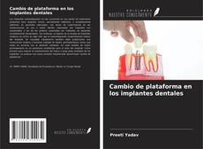 Cambio de plataforma en los implantes dentales kitap kapağı