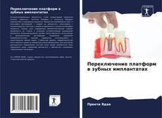 Переключение платформ в зубных имплантатах的封面