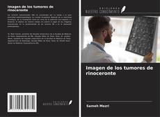 Copertina di Imagen de los tumores de rinoceronte