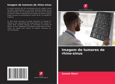Buchcover von Imagem de tumores de rhino-sinus