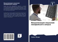 Buchcover von Визуализация опухолей носорожьего синуса