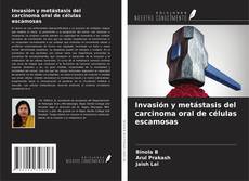 Обложка Invasión y metástasis del carcinoma oral de células escamosas