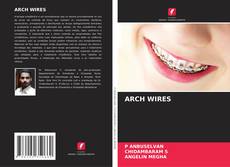 Portada del libro de ARCH WIRES
