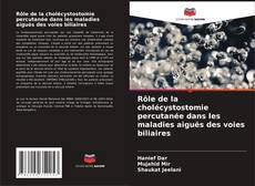 Borítókép a  Rôle de la cholécystostomie percutanée dans les maladies aiguës des voies biliaires - hoz