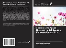 Buchcover von Síndrome de Apnea Obstructiva del Sueño y Síndrome Metabólico