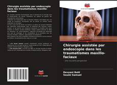 Couverture de Chirurgie assistée par endoscopie dans les traumatismes maxillo-faciaux