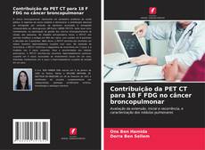 Bookcover of Contribuição da PET CT para 18 F FDG no câncer broncopulmonar