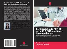 Capa do livro de Contribuição da PET CT para 18 F FDG no câncer broncopulmonar 