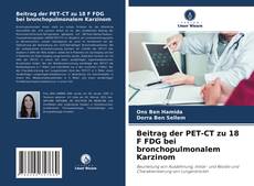 Portada del libro de Beitrag der PET-CT zu 18 F FDG bei bronchopulmonalem Karzinom