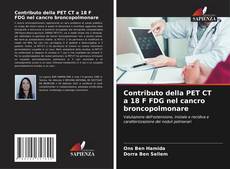 Bookcover of Contributo della PET CT a 18 F FDG nel cancro broncopolmonare