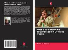 Bookcover of Atlas da síndrome de Esquirol-Séguin-Down no Iraque