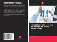 Bookcover of Hemostasia endoscópica da doença da úlcera hemorrágica