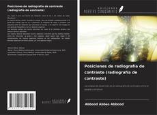 Bookcover of Posiciones de radiografía de contraste (radiografía de contraste)
