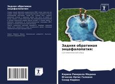 Bookcover of Задняя обратимая энцефалопатия: