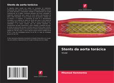 Bookcover of Stents da aorta torácica