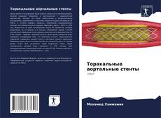 Bookcover of Торакальные аортальные стенты
