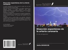 Bookcover of Disección espontánea de la arteria coronaria