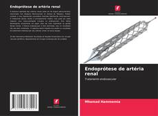 Bookcover of Endoprótese de artéria renal