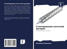 Bookcover of Стентирование почечной артерии