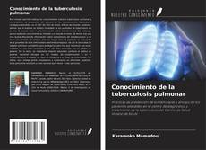 Conocimiento de la tuberculosis pulmonar的封面