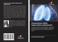 Conoscenza della tubercolosi polmonare kitap kapağı