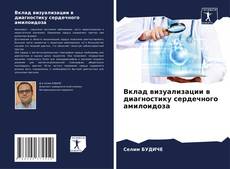 Bookcover of Вклад визуализации в диагностику сердечного амилоидоза