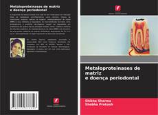 Bookcover of Metaloproteinases de matriz e doença periodontal