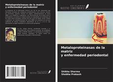 Capa do livro de Metaloproteinasas de la matriz y enfermedad periodontal 