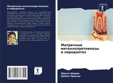 Buchcover von Матричные металлопротеиназы и пародонтоз