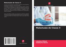 Bookcover of Maloclusão de Classe II
