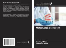 Bookcover of Maloclusión de clase II